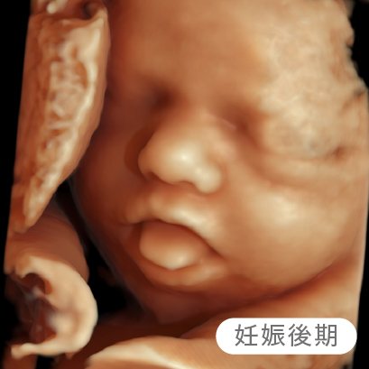 妊娠後期